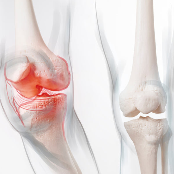 Întărește sistemul osteoarticular